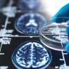 3D-Hirngewebemodell soll Alzheimer-Forschung verbessern